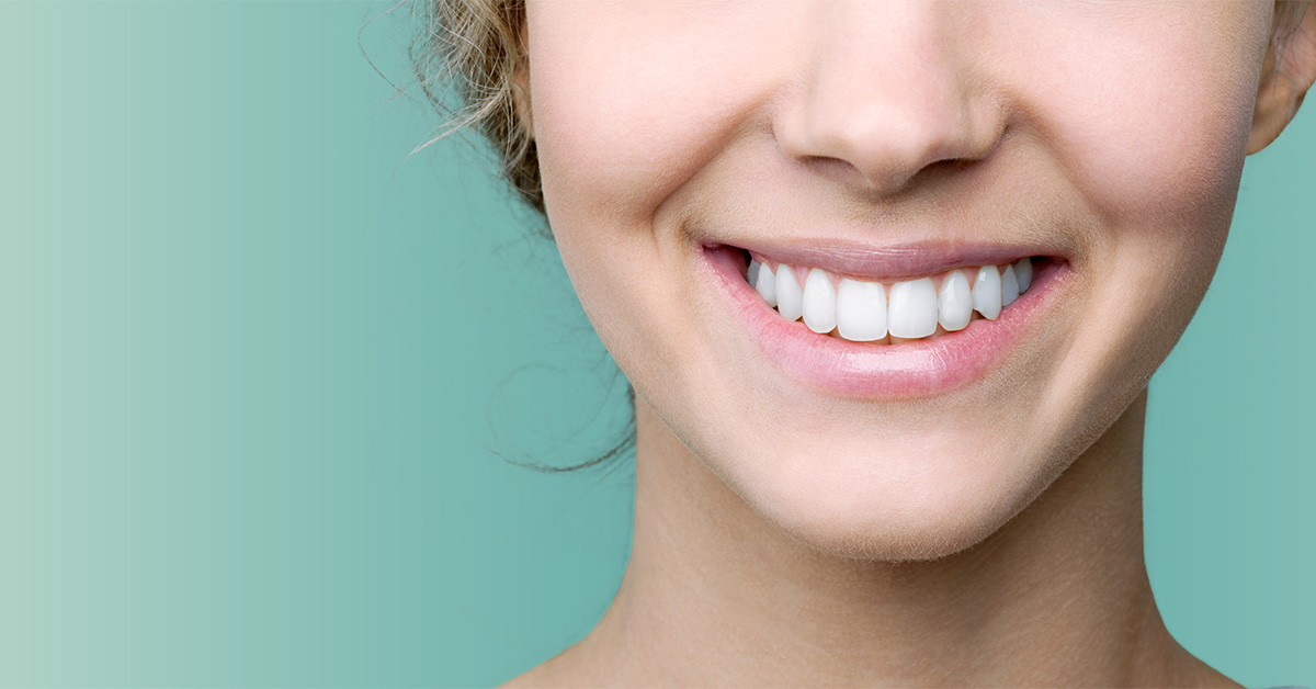 Tooth Discoloration