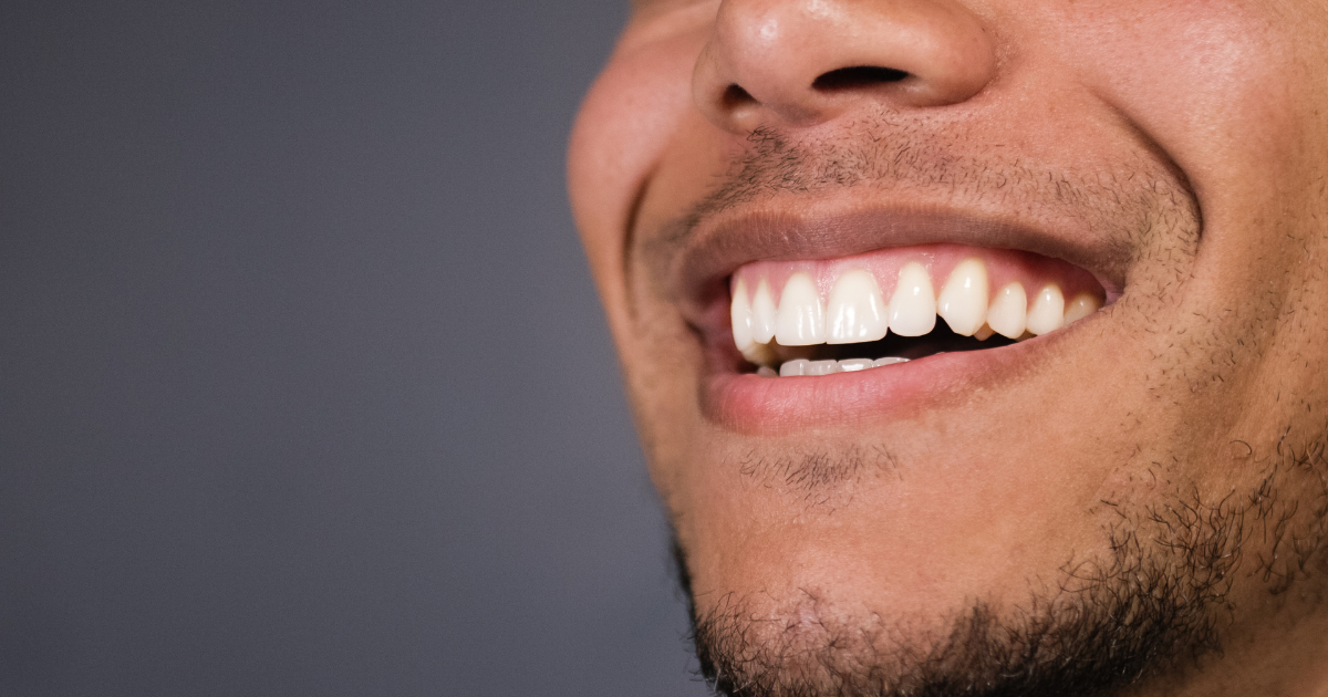 how to get rid of a gummy smile