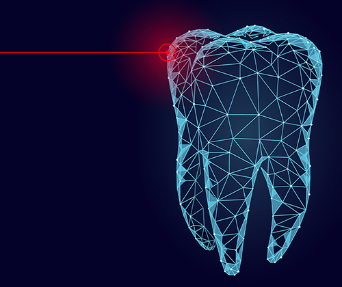 Laser gum surgery