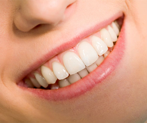 periodontal